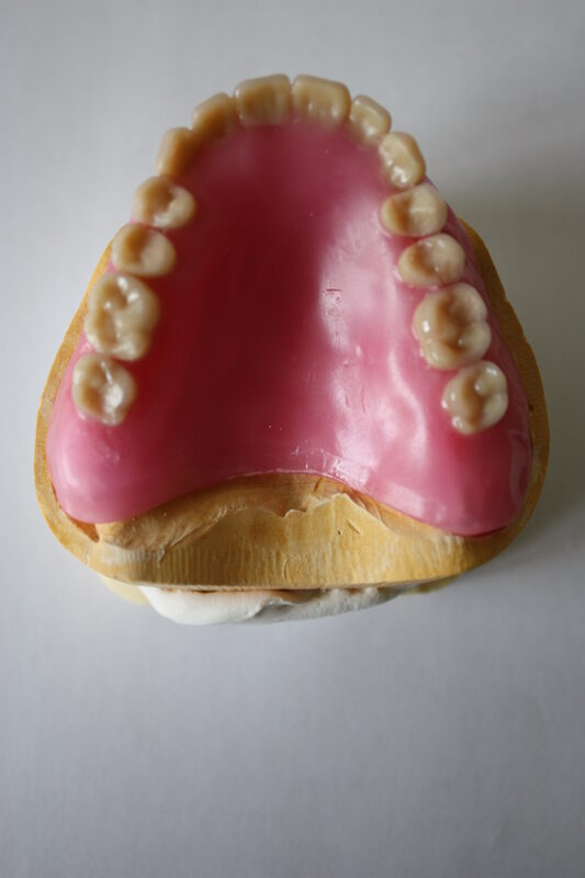 Carbon Launches DB 4000, a Tougher FDA-Cleared Denture Base Resin for Digital Dentures