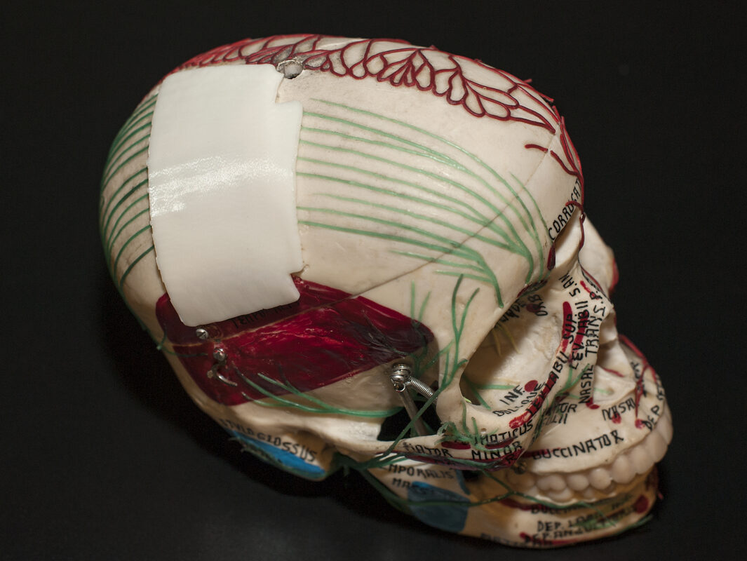 European Neurosurgeons Bring 3D Printing In-House