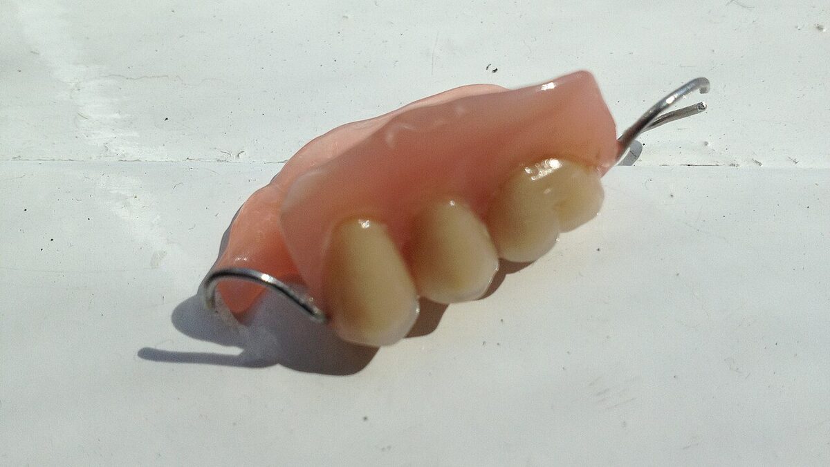 GC GRADIA PREMi: A Hybrid Ceramic Resin That Only Prints on SprintRay's Midas Press