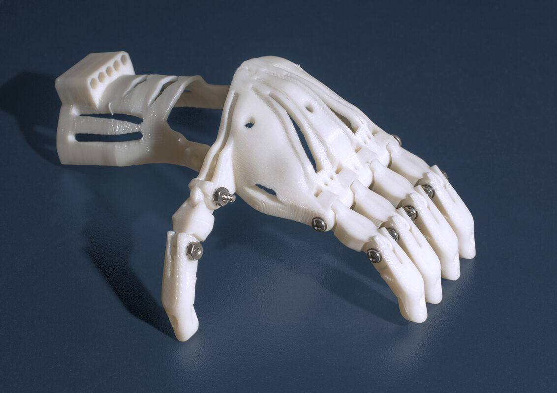 Queen's University Students Open-Source a Battery-Free 3D-Printed Prosthetic Arm for Refugees on the Thai-Myanmar Border